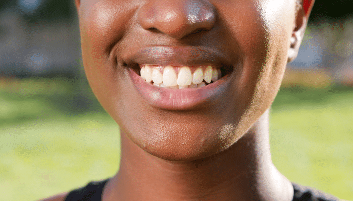 How Missing Teeth Can Change Facial Shape